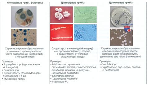 Грибковые инфекции