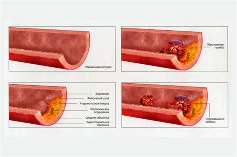 Заболевания отражающиеся на состоянии сосудов