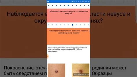 Зеленая родинка: диагностика