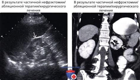Значение кортико-медуллярной дифференциации