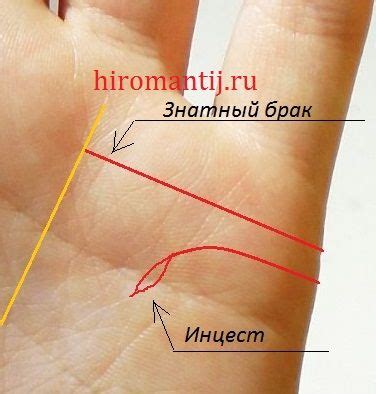Значение резкого завершения линии брака