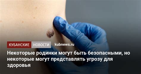 Значение родинки сердцем для здоровья