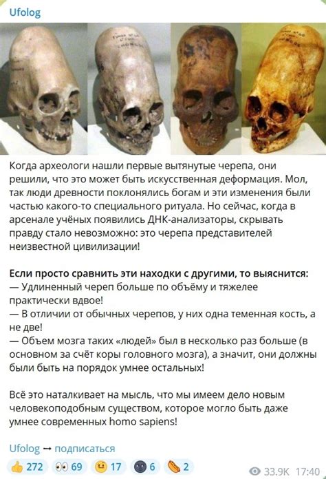 История и происхождение шеврона черепа