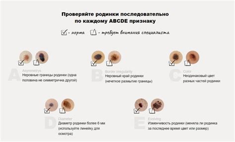 Как определить подлинность родинки-сердца