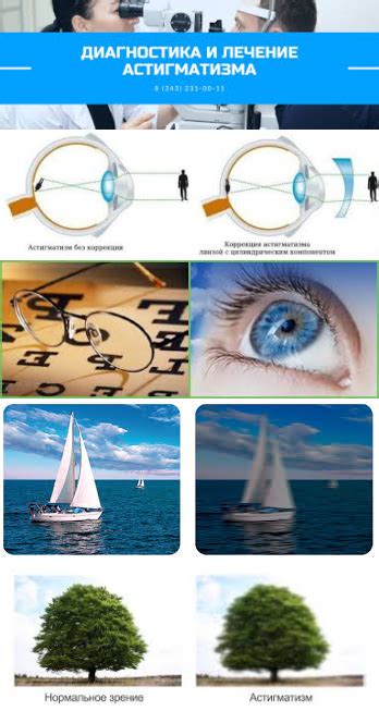 Как сохранить зрительное здоровье при расфокусировке зрения