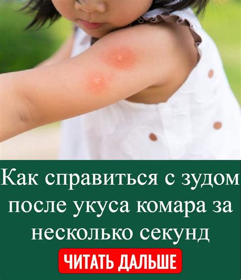 Как справиться с зудом и уменьшить дискомфорт