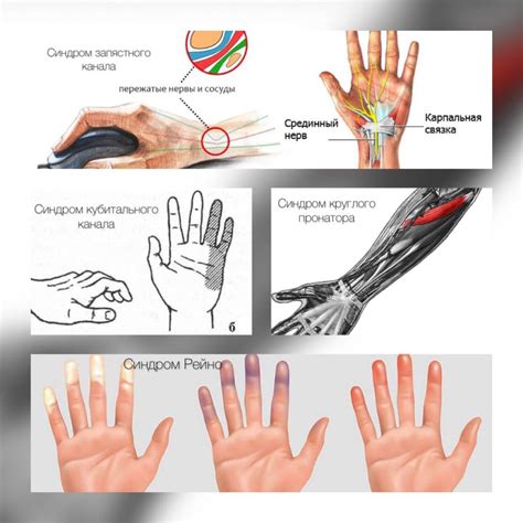 Механические повреждения правой руки