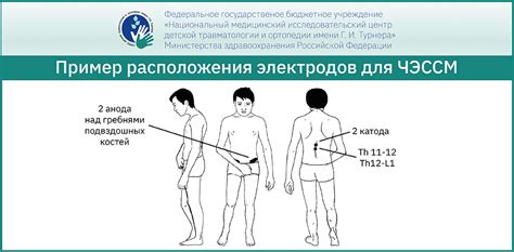 Механические стимуляции