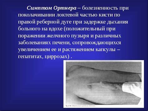 Описание симптома