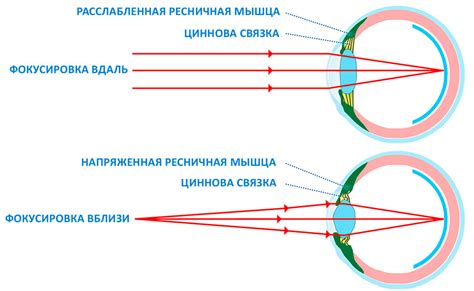 Определение и причины расфокусировки зрения