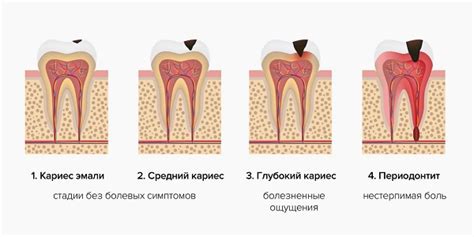 Основные причины подкидывания зубов