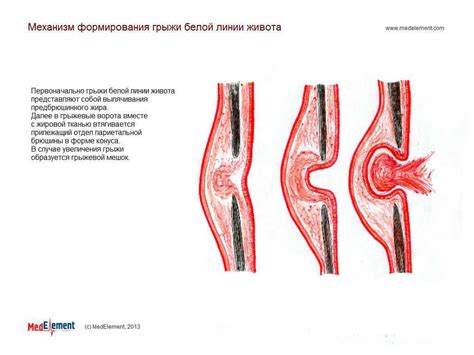 Особенности и симптомы частичного прослеживания линии перелома