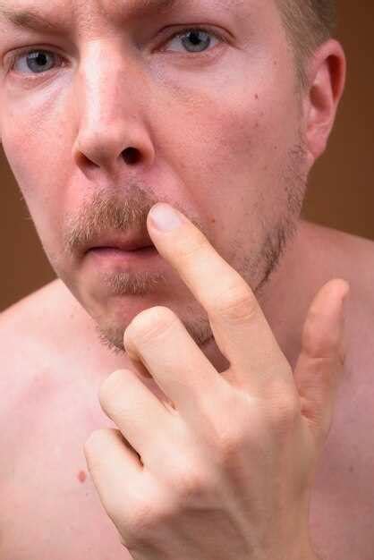 Плохое контактирование с кожей