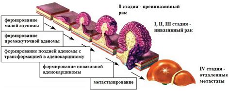 Причины возникновения эпителиального образования прямой кишки