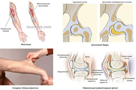 Причины и лечение прохождения тока по телу