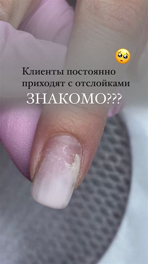 Причины перепиливания ногтевой пластины