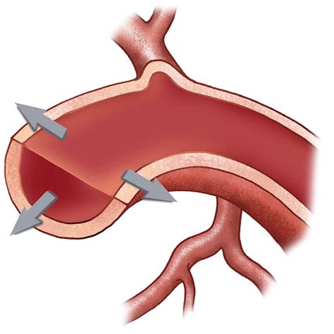 Проблемы, связанные с маточной трубой извитой
