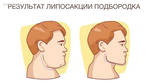 Происхождение раздвоенного подбородка