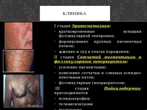 Профилактика гиперемии