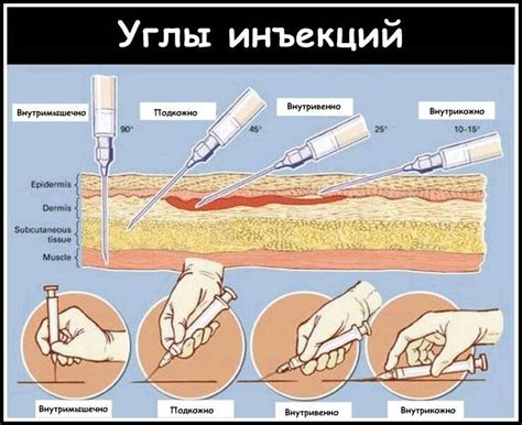 Процесс дезинфекции укола иглой и необходимость его проведения