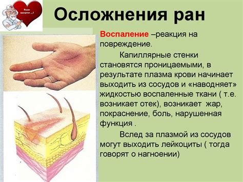 РАН и его значения