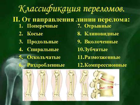 Раскрытие понятия: частичное прослеживание линии перелома
