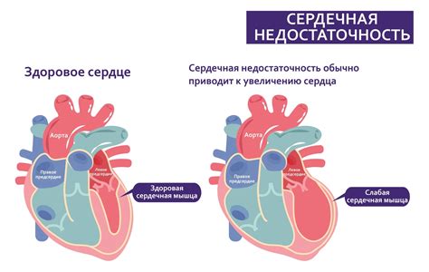 Сердечная недостаточность и влияние на периферическое сосудистое сопротивление