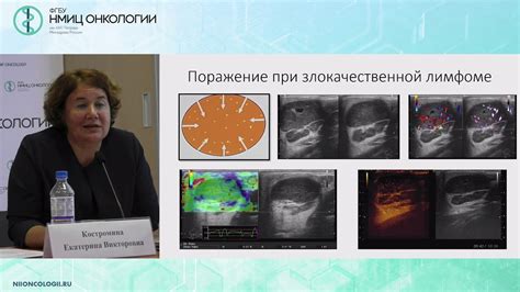 Симптомы и диагностика отсутствия визуализации регионарных лимфатических узлов