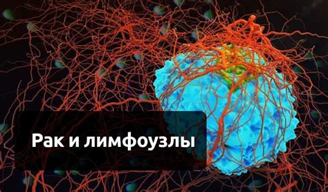 Симптомы поражения ретрокруральных лимфоузлов