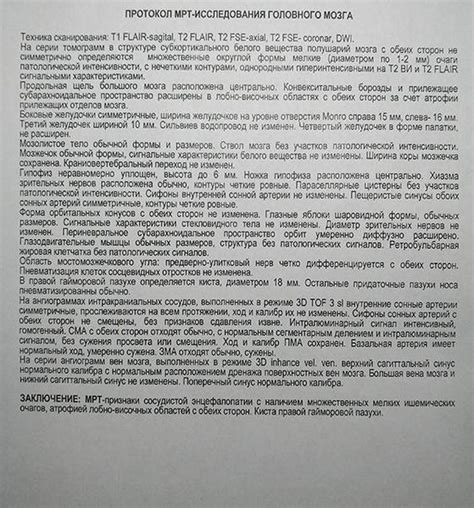 Снижение сигналов дисков по Т2