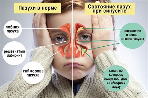 Физиологические причины для трогания носа