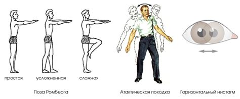 Физические симптомы расширения борозд мозжечка
