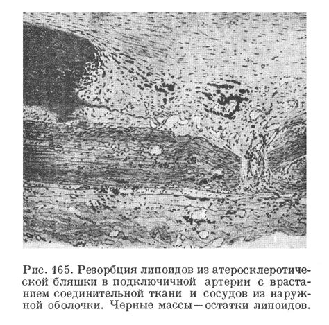 Формы с полным размещением артерий