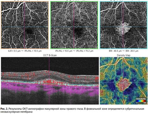 Функция пигмента в макулярной зоне