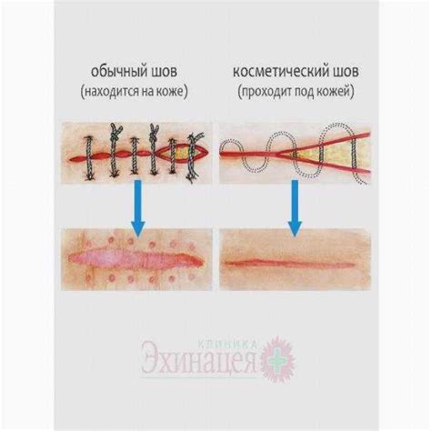 Чешутся швы после операции: причины и решения