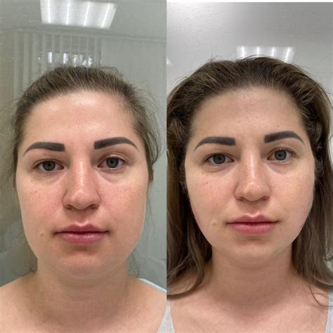 Что такое миловидность лица