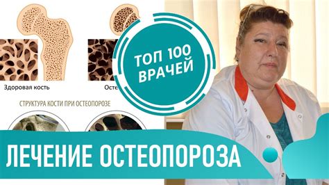  Увеличение риска остеопороза от salt boost 